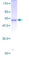 12.5% SDS-PAGE Stained with Coomassie Blue.